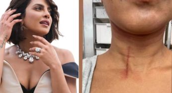 Priyanka Chopra Shares Injury Glimpse from ‘The Bluff’ Set