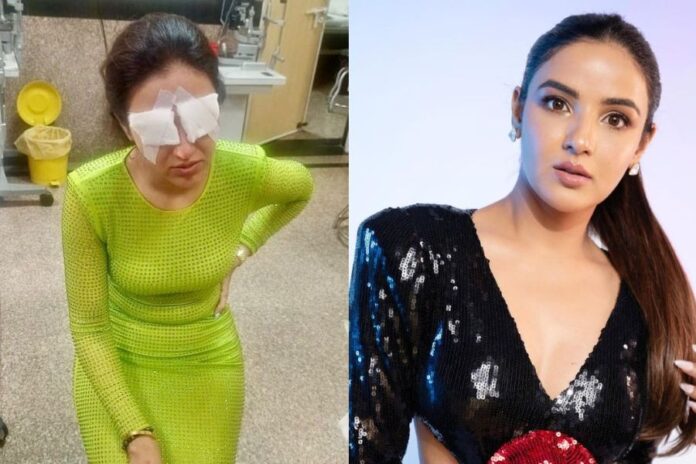 Jasmine Bhasin Shares Her Eye Infection Recovery Journey