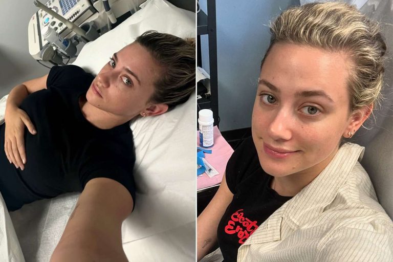 Riverdale Actress Lili Reinhart Reveals About Her “Mysterious Disease”