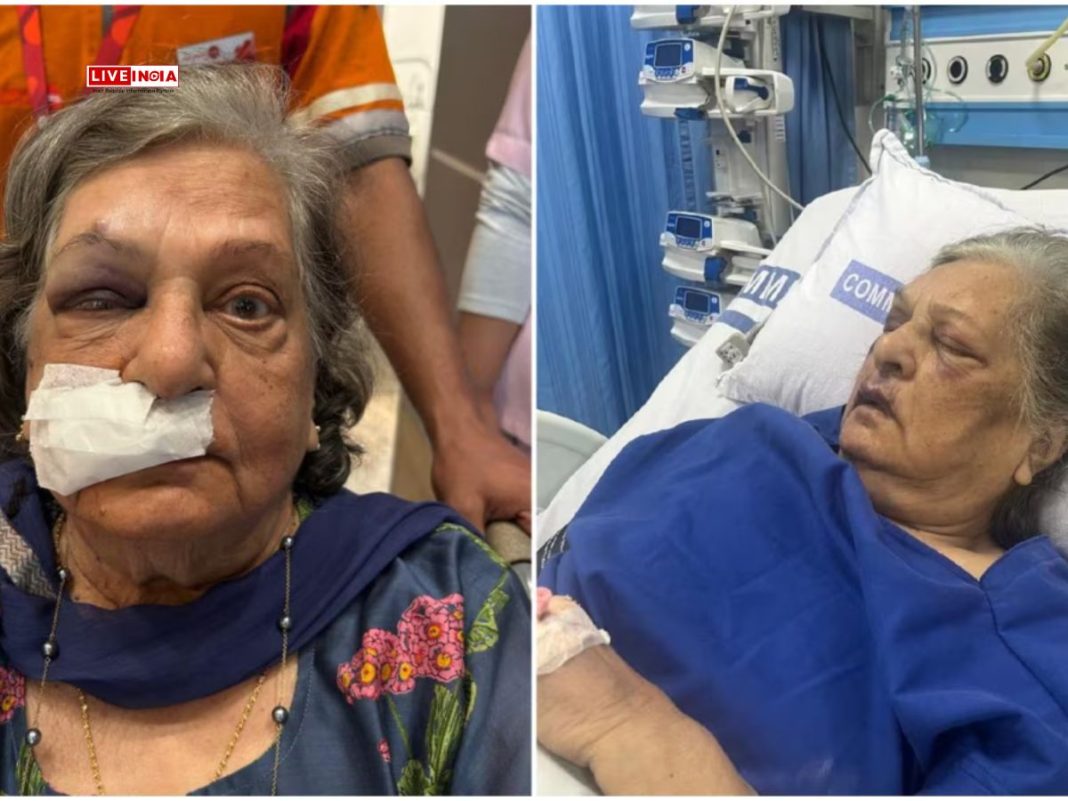 82-Year-Old Woman Falls, Hospitalised After Air India Denies Pre-Booked Wheelchair