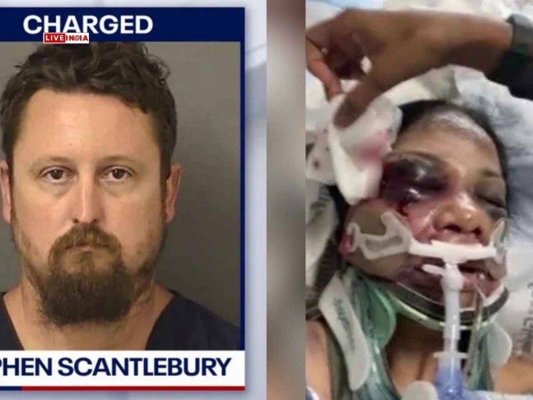 Indian-Origin Nurse Brutally Attacked in US Hospital; Assailant Says 'Indians Are Bad', 'I Beat The F#**...'