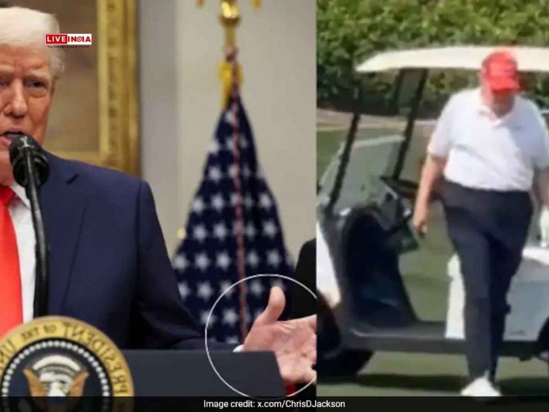 Trump’s “Wobble” And Mysterious Hand Marks Spark Health Concerns Online-Watch Viral Video