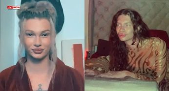 Australian Woman Spends ₹6.6 Lakh on Cosmetic Surgeries to Look Like a Cat! Now Regrets it