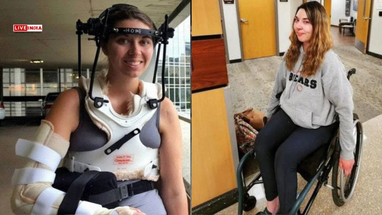 Unbelievable: Decapitated U.S. Woman Gets Head Attached to Body Again After 37 Surgeries