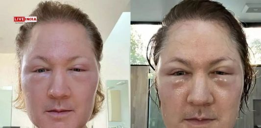 "I Removed All My Plasma, Replaced it With...": Anti-Ageing Guru Bryan Johnson's Bizarre New Experiment