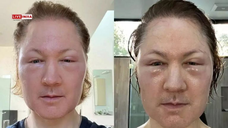 "I Removed All My Plasma, Replaced it With...": Anti-Ageing Guru Bryan Johnson's Bizarre New Experiment