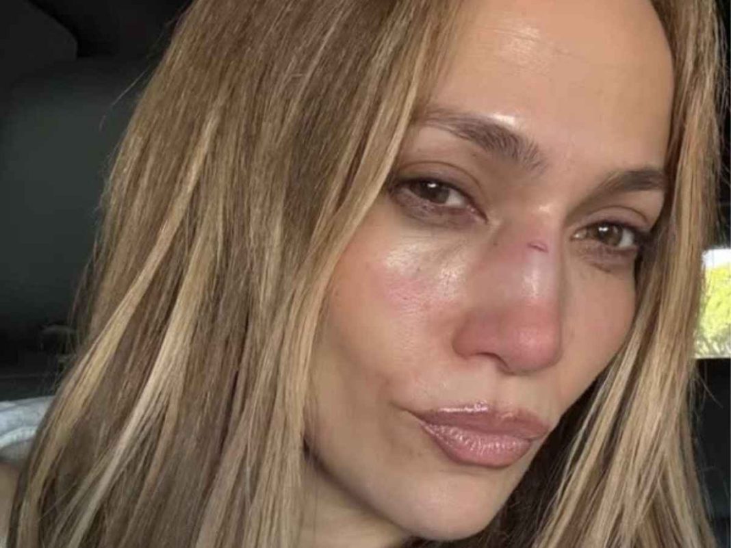 Jennifer Lopez’s Rehearsal Mishap Leaves Her Bruised Before Big AMAs Comeback