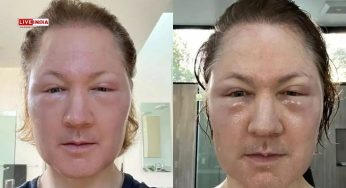 “I Removed All My Plasma, Replaced it With…”: Anti-Ageing Guru Bryan Johnson’s Bizarre New Experiment