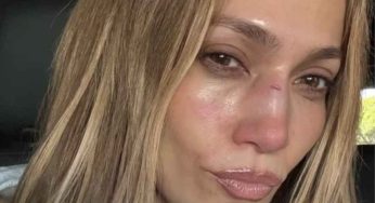 Jennifer Lopez’s Rehearsal Mishap Leaves Her Bruised Before Big AMAs Comeback