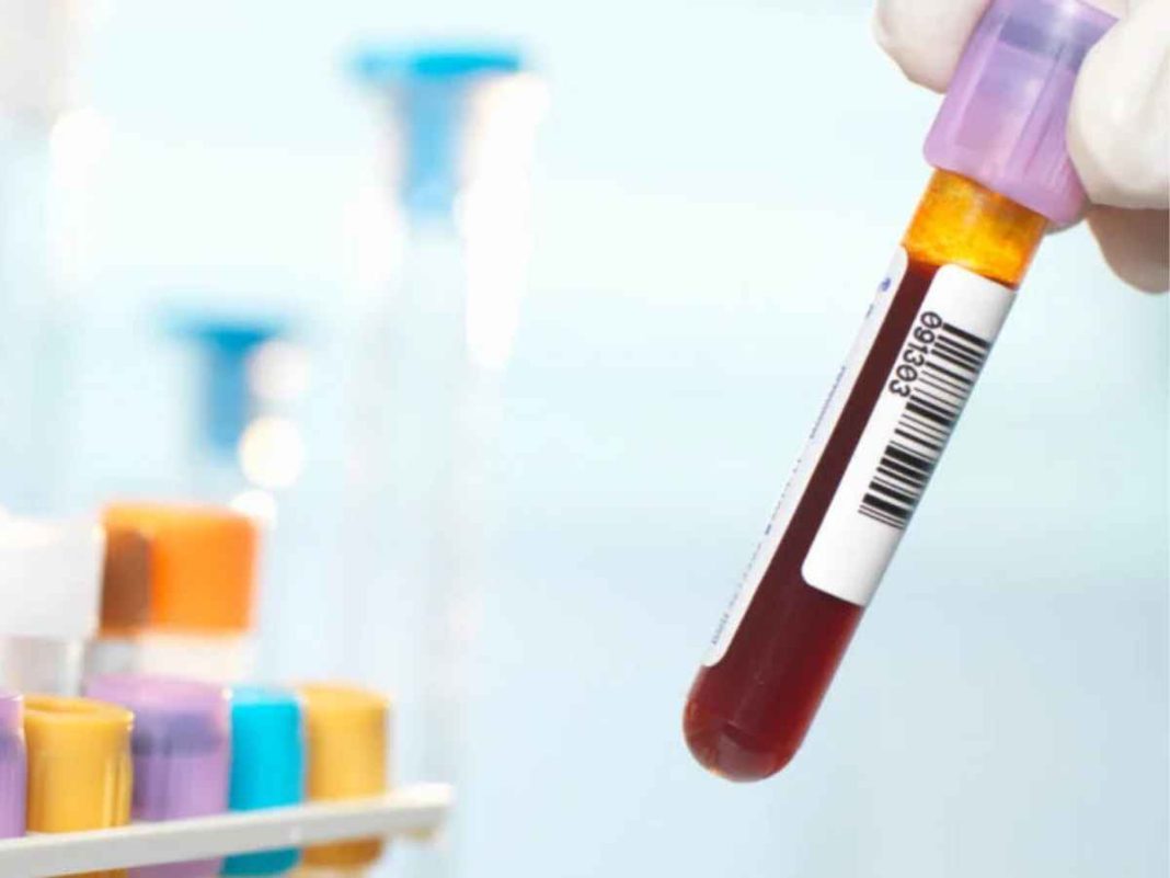 ‘Gwada Negative’: The World's Rarest Blood Group Uncovered