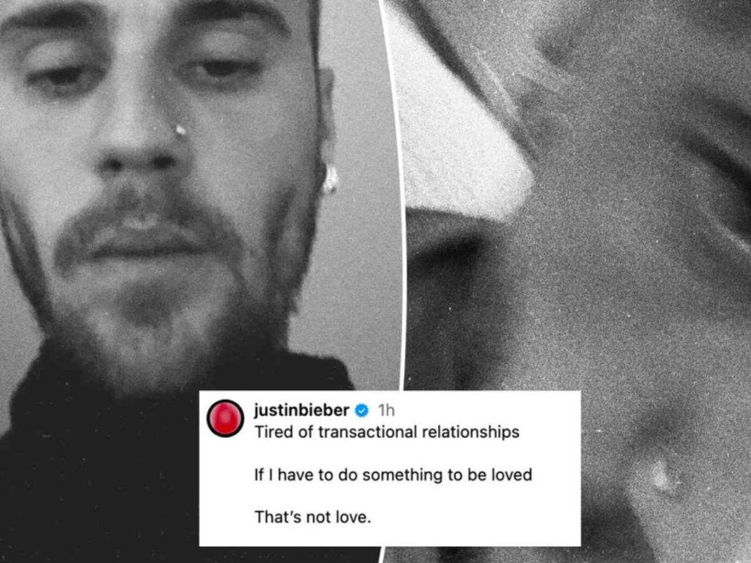 Justin Bieber’s Cryptic Posts Raise Eyebrows: 'That’s Not Love'
