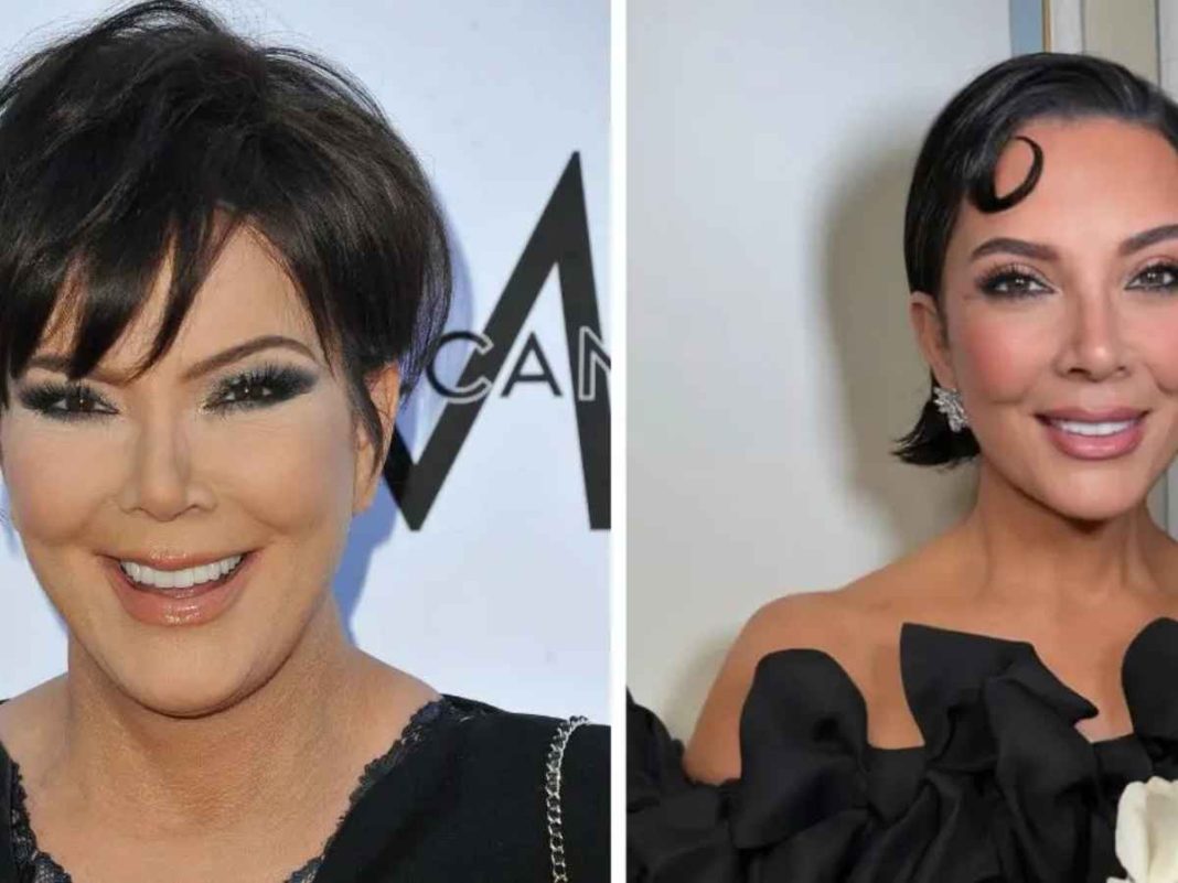 From Botox to Facelifts: Kris Jenner’s Complete Plastic Surgery Breakdown