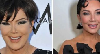 From Botox to Facelifts: Kris Jenner’s Complete Plastic Surgery Breakdown