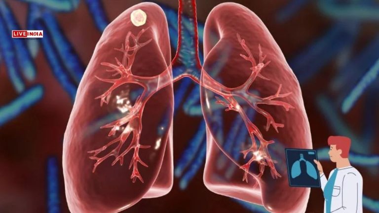 One in Three Young Adults in Delhi Show Early Signs of Lung Damage, CT Scan Data Reveals