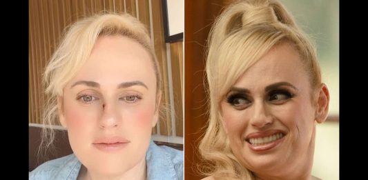 Rebel Wilson Reveals “Terrible Accident” On Bride Hard Set