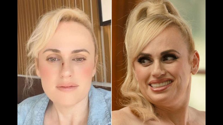 Rebel Wilson Reveals “Terrible Accident” On Bride Hard Set