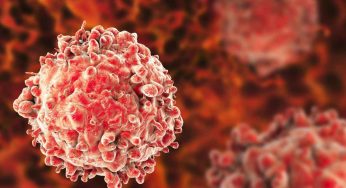 Acute Myeloid Leukemia: From Fatigue To Fever, The Subtle Symptoms To Know