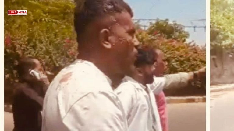 Miraculous! Passenger on Seat 11A Survives Air India Crash, Says, “Bodies All Around Me”