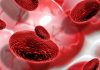 Silent Progression: 5 Reasons Why Blood Cancers Often Go Unnoticed Silent Progression: 5 Reasons Why Blood Cancers Often Go Unnoticed