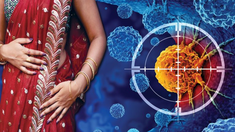 What Is ‘Saree Cancer’? Rare Skin Condition Linked To Years Of Tight Waist Tying