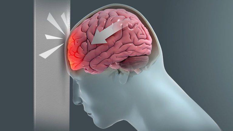 Children With Brain Injuries Face Higher Risk Of Anxiety, Depression: Major Study Finds