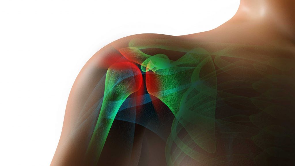 Frozen Shoulder In Diabetes: Why ‘Diabetes Shoulder’ Happens And How To Manage It Early