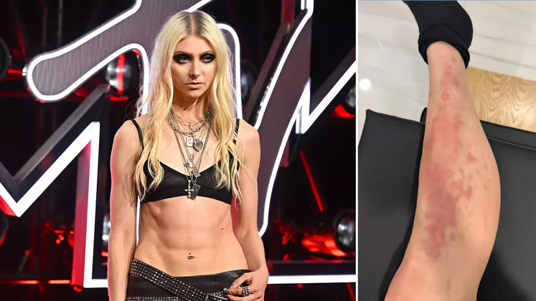 Taylor Momsen Hospitalized In Mexico City After Venomous Spider Bite
