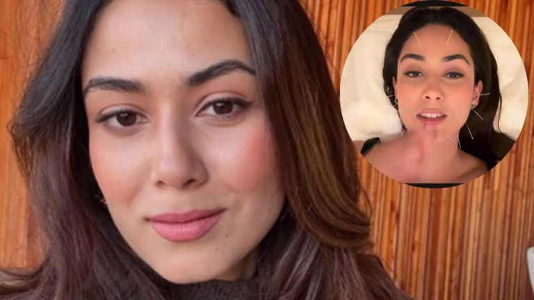 Mira Kapoor Touts Cosmetic Acupuncture: Here’s What The Trending Beauty Treatment Is About