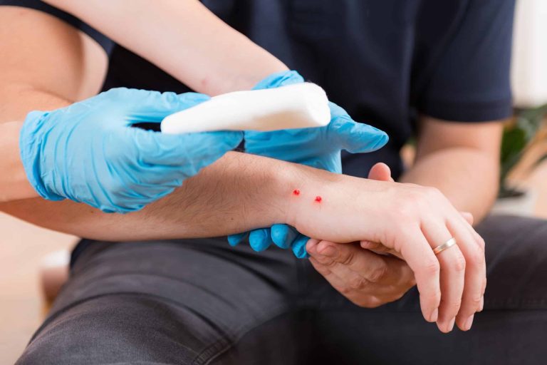 Snakebite First Aid: What To Do In The Critical First Hour
