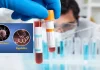 Syphilis and Gonorrhoea Cases Surge Across Europe as STI Levels Hit Decade Highs Syphilis and Gonorrhoea Cases Surge Across Europe as STI Levels Hit Decade Highs