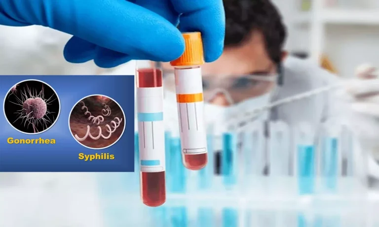 Syphilis and Gonorrhoea Cases Surge Across Europe as STI Levels Hit Decade Highs
