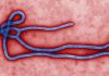 What Is Ebola? Symptoms, Causes, Treatment and Key Facts About the Deadly Virus What Is Ebola? Symptoms, Causes, Treatment and Key Facts About the Deadly Virus