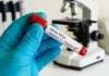 Ebola Outbreak: Experts Urge Vigilance, Say No Need To Panic In India Amid a growing Ebola outbreak in parts of Central and East Africa, health experts in India have urged caution but said there is no immediate reason for panic in the country.