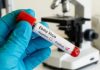 Karnataka Rules Out Ebola Case In Bengaluru Karnataka Rules Out Ebola Case In Bengaluru