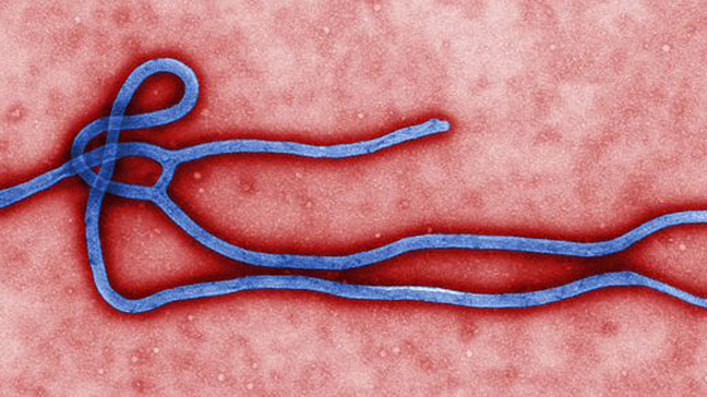 What Is Ebola? Symptoms, Causes, Treatment and Key Facts About the Deadly Virus