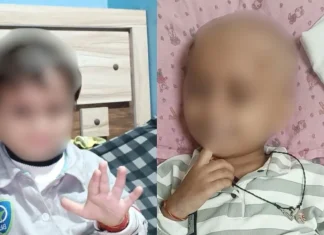 AIIMS Bhopal Tragedy: 3-Year-Old Cancer Patient Dies After Alleged Formalin Injection, Two Nurses Booked AIIMS Bhopal Tragedy: 3-Year-Old Cancer Patient Dies After Alleged Formalin Injection, Two Nurses Booked