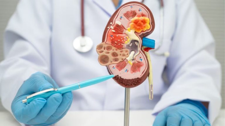 Kidney Cancer Often Develops Silently: Key Warning Signs You Should Never Ignore