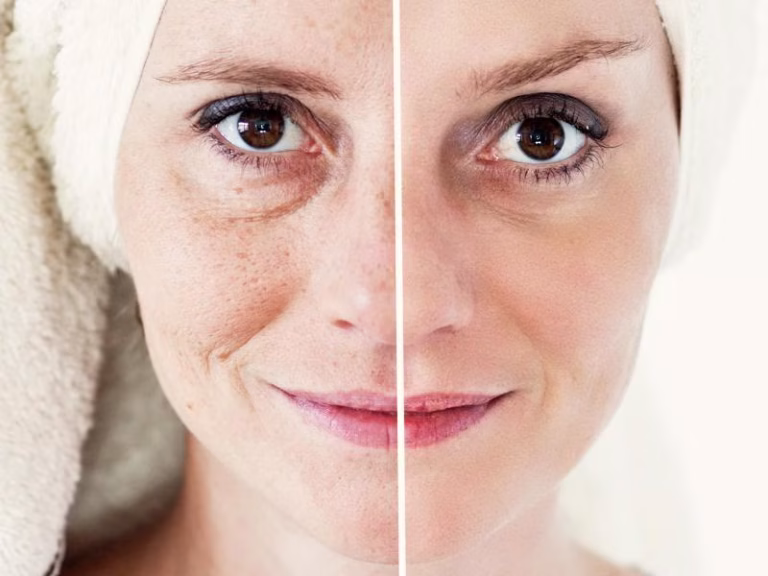 Stress, Screen Time And Sun Exposure Are Making Skin Age Faster, Experts Warn