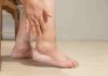 Summer Swelling Explained: Why Your Hands And Feet Puff Up In Hot Weather And How To Reduce It Summer Swelling Explained: Why Your Hands And Feet Puff Up In Hot Weather And How To Reduce It
