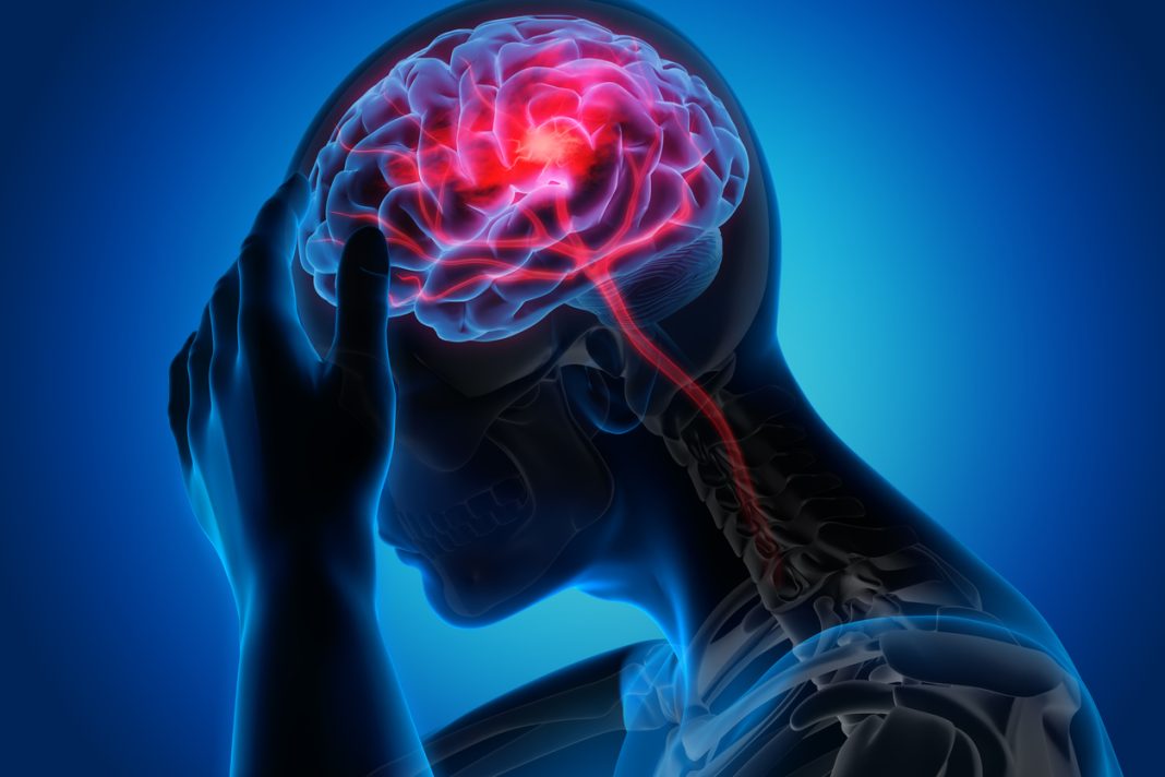 No Visible Symptoms: How A Silent Heart Tumour Triggered A Brain Stroke In A Teenager