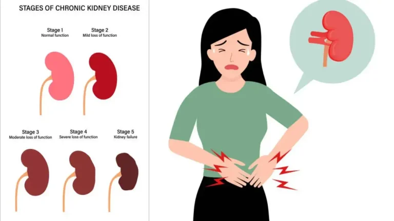 Explained: The Rare Pregnancy-Related Kidney Condition Behind Rajasthan Mothers' Euthanasia Plea