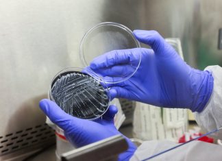 Fifth Death Reported In New York City Legionnaires’ Disease Outbreak As Investigation Continues Fifth Death Reported In New York City Legionnaires’ Disease Outbreak As Investigation Continues
