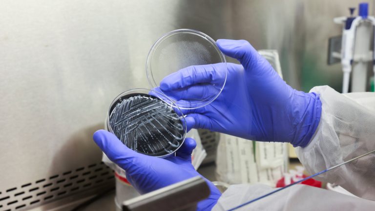 Fifth Death Reported In New York City Legionnaires’ Disease Outbreak As Investigation Continues