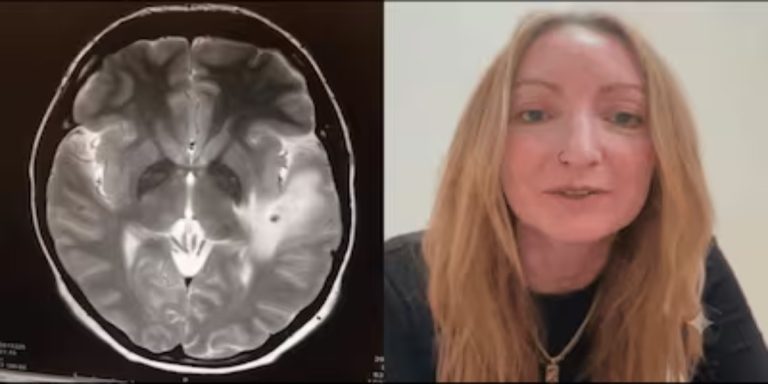 UK Backpacker’s Travel Nightmare Highlights Dangers of Silent Brain Infection: What is Neurocysticercosis?