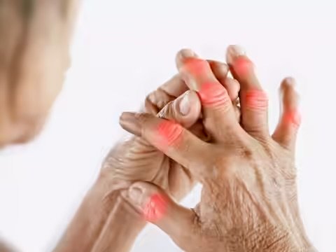 High Uric Acid and Swollen Hands or Feet? These 3 Foods May Be Making It Worse