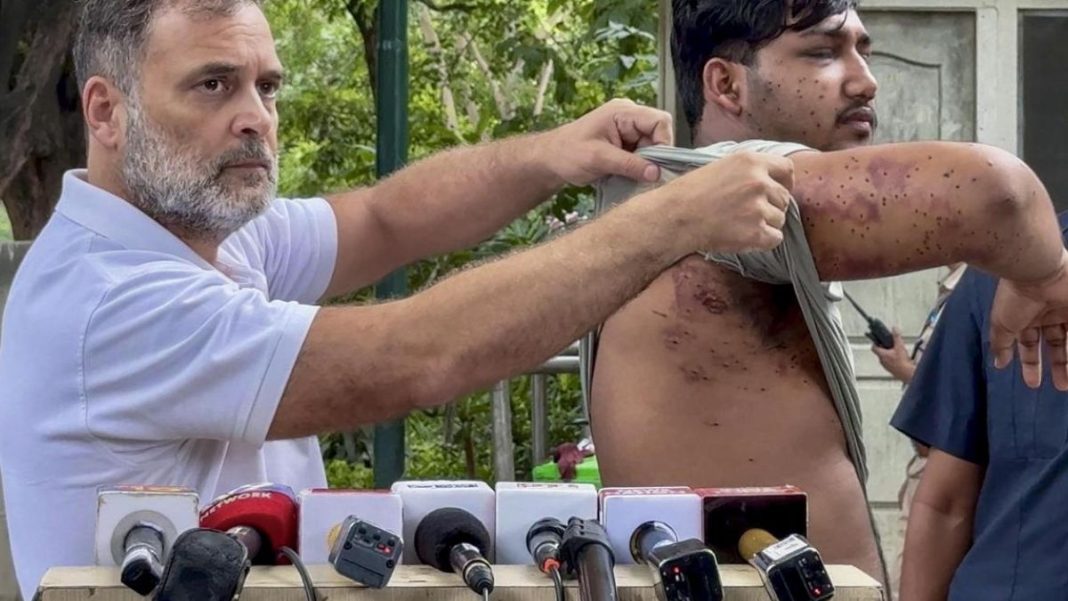 Rahul Gandhi Alleges Pellet Guns Used On Student Protesters
