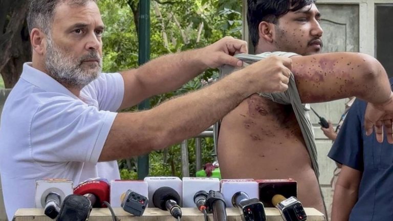 Rahul Gandhi Alleges Pellet Guns Used On Student Protesters